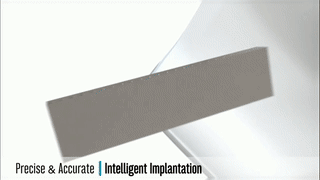 你的脫發有救了！搭載ARTAS系統的KUKA機器人將成為你的植發醫生